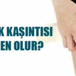 Bacak Kaşıntısı Neden Olur, Sebepleri Nelerdir ve Ne İyi Gelir?