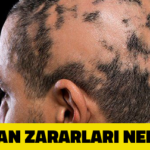 Saçkıran Zararları Nelerdir?